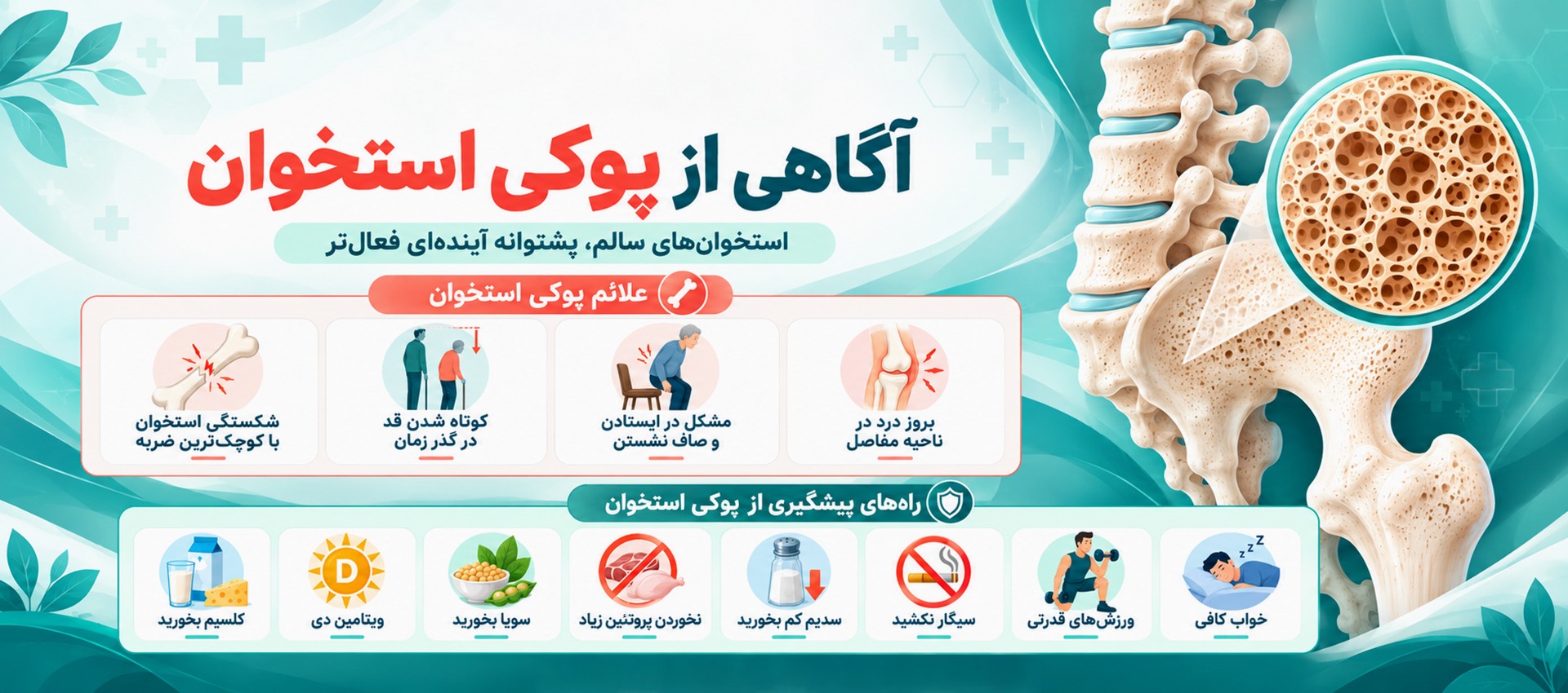 پوکی استخوان